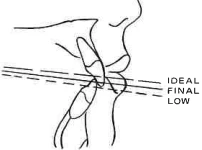 Manual Illustration
